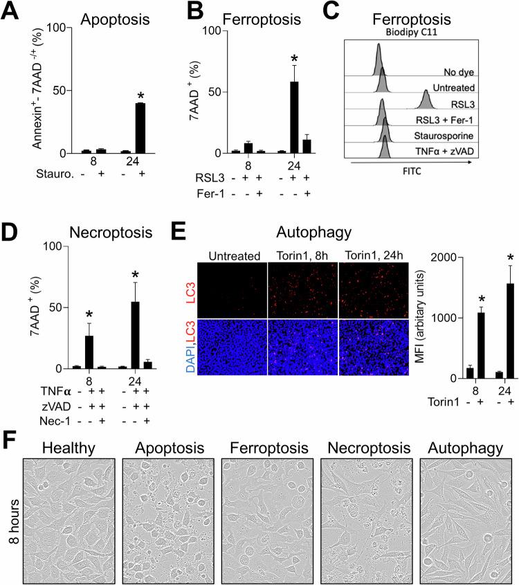 https://cdn.ncbi.nlm.nih.gov/pmc/blobs/5d10/12085637/b624df296cea/41419_2025_7704_Fig1_HTML.jpg