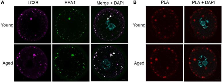 https://cdn.ncbi.nlm.nih.gov/pmc/blobs/5d14/8277196/7b632ecdec47/fcell-09-691826-g007.jpg