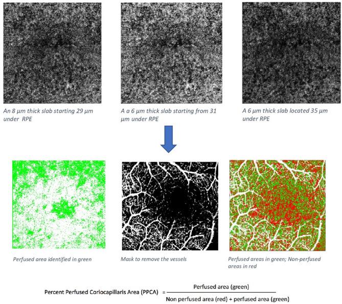 https://cdn.ncbi.nlm.nih.gov/pmc/blobs/5d18/12211357/1c1274f67076/12886_2025_4163_Fig1_HTML.jpg