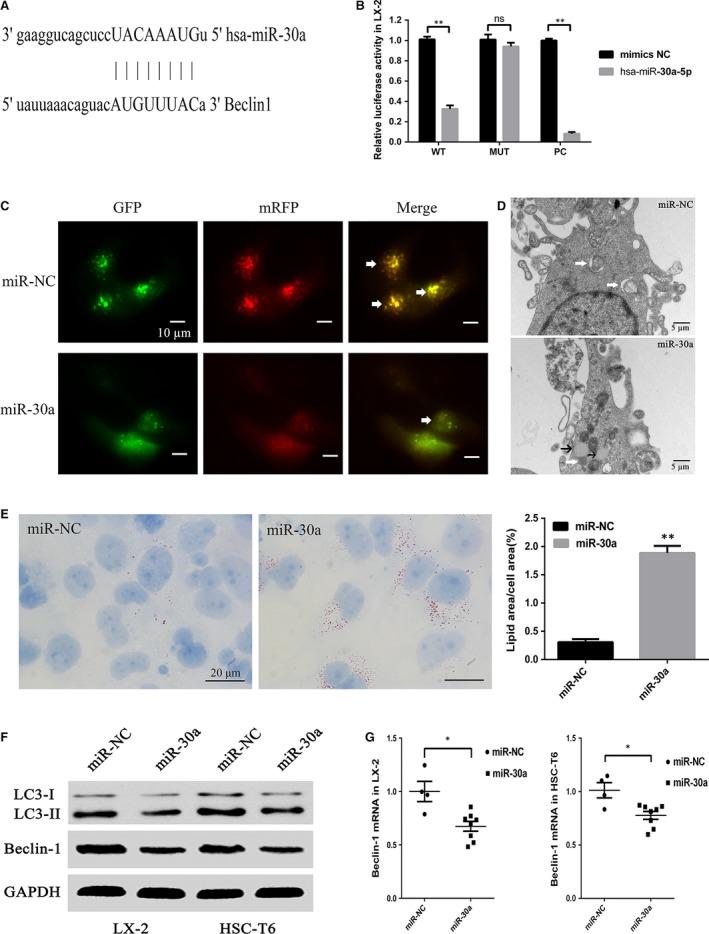 https://cdn.ncbi.nlm.nih.gov/pmc/blobs/5d1a/5706581/7d3e750f5cd7/JCMM-21-3679-g003.jpg