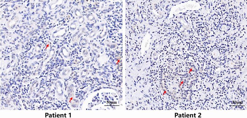 https://cdn.ncbi.nlm.nih.gov/pmc/blobs/5d1e/9743537/805df5094c3f/10020_2022_578_Fig11_HTML.jpg
