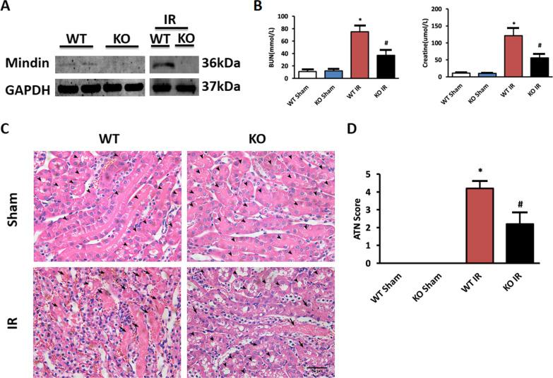 https://cdn.ncbi.nlm.nih.gov/pmc/blobs/5d1e/9743537/8e5da6cebdf3/10020_2022_578_Fig2_HTML.jpg