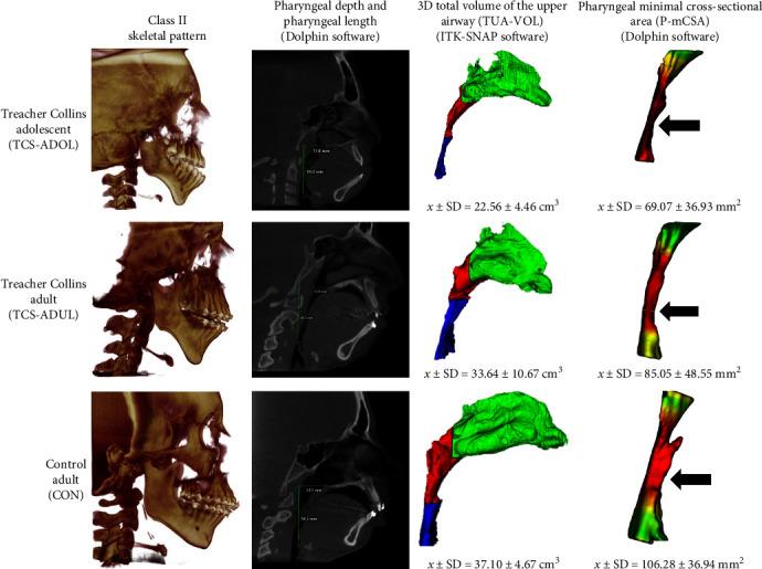 https://cdn.ncbi.nlm.nih.gov/pmc/blobs/5d24/11221962/d558be6d3e0e/IJD2024-6545790.004.jpg