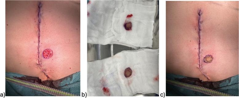 https://cdn.ncbi.nlm.nih.gov/pmc/blobs/5d28/11847029/8ed3dc12a505/gr3.jpg