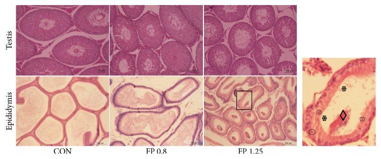 https://cdn.ncbi.nlm.nih.gov/pmc/blobs/5d29/5514346/3cef7e6f0df3/ECAM2017-6958982.008.jpg
