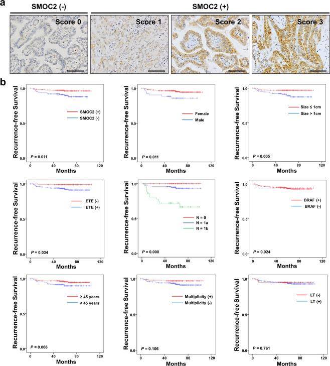 https://cdn.ncbi.nlm.nih.gov/pmc/blobs/5d3b/7078233/67a40ba6d88e/41598_2020_61828_Fig5_HTML.jpg