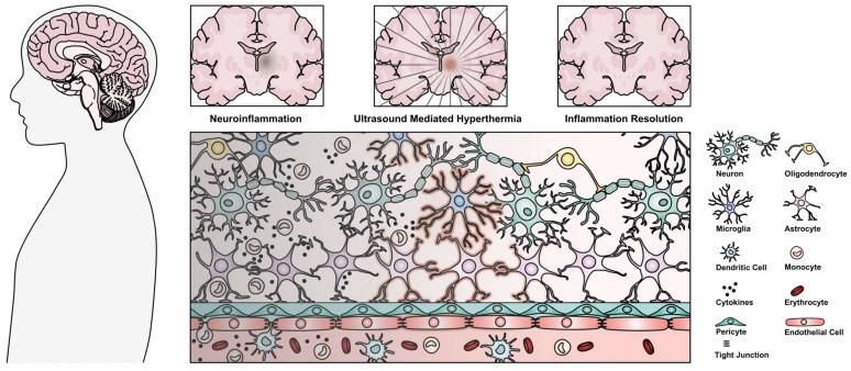 https://cdn.ncbi.nlm.nih.gov/pmc/blobs/5d3f/11155413/032bd3be9590/thnov14p3150g001.jpg