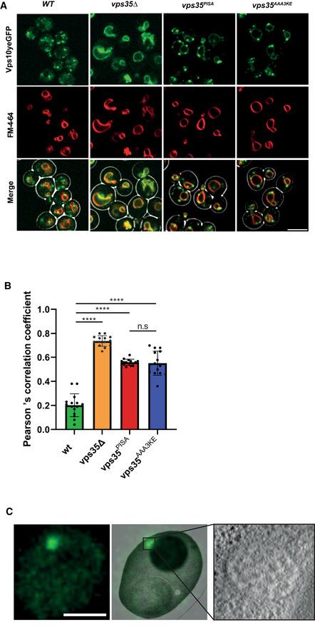 https://cdn.ncbi.nlm.nih.gov/pmc/blobs/5d41/9841331/84a009062c54/EMBJ-42-e112287-g007.jpg