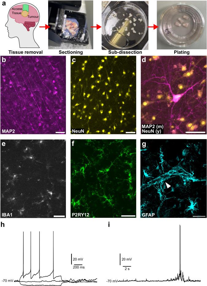 https://cdn.ncbi.nlm.nih.gov/pmc/blobs/5d44/12044016/d4829bc49b69/41467_2025_58879_Fig1_HTML.jpg