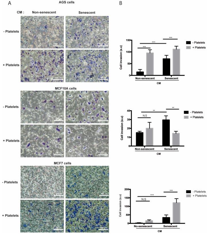https://cdn.ncbi.nlm.nih.gov/pmc/blobs/5d56/6862446/e9abfb23c1c4/ijms-20-05292-g005.jpg