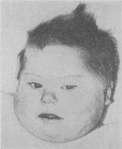 https://cdn.ncbi.nlm.nih.gov/pmc/blobs/5d63/2166549/fe59cf79ec15/brmedj02393-0057-a.jpg