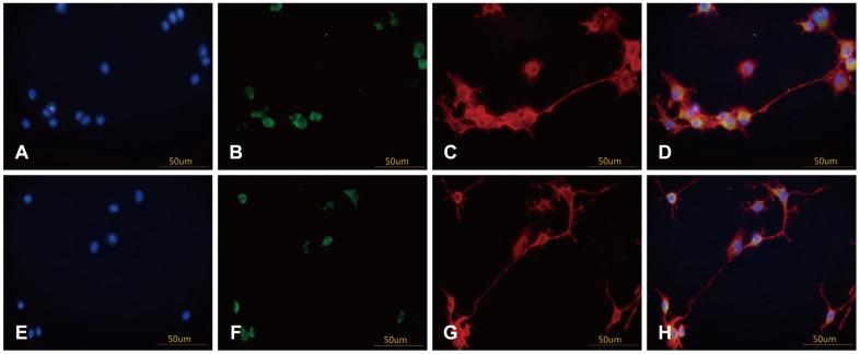https://cdn.ncbi.nlm.nih.gov/pmc/blobs/5d67/3936568/ea81e9a0262e/kja-16-47-g003.jpg