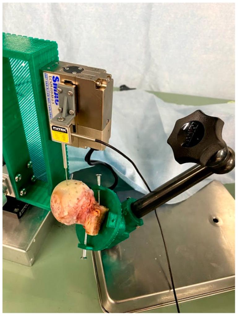 https://cdn.ncbi.nlm.nih.gov/pmc/blobs/5d6c/10525776/32887428c28c/bioengineering-10-01050-g005.jpg