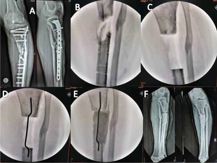 https://cdn.ncbi.nlm.nih.gov/pmc/blobs/5d70/9372116/9c5717d6d115/264_2022_5494_Fig1_HTML.jpg