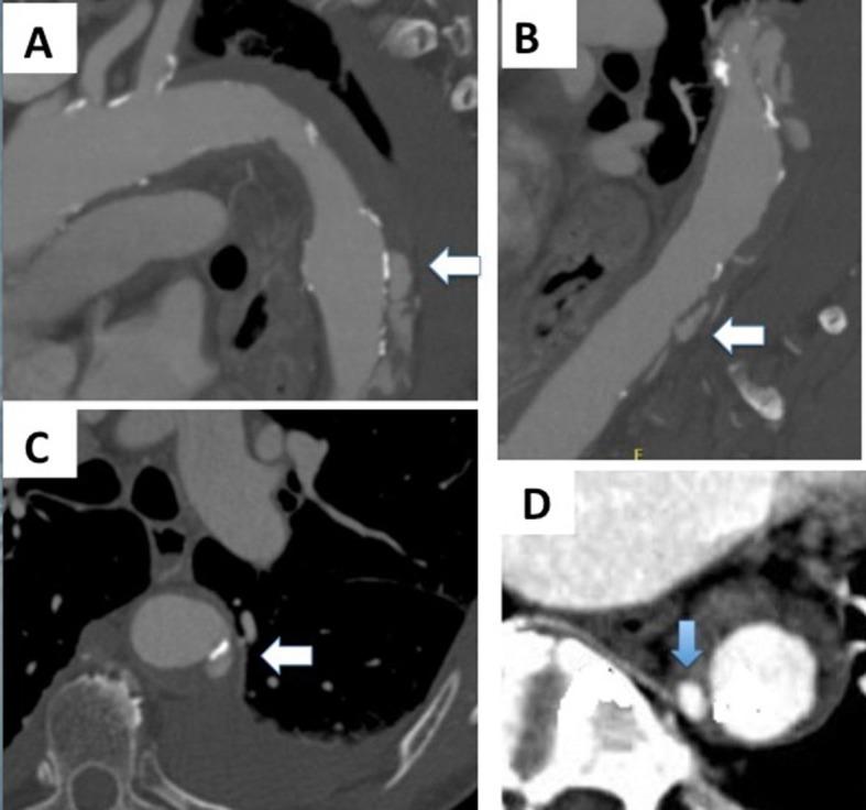 https://cdn.ncbi.nlm.nih.gov/pmc/blobs/5d77/6636911/7f9b57162391/jvb-18-e20180119-g02-en.jpg
