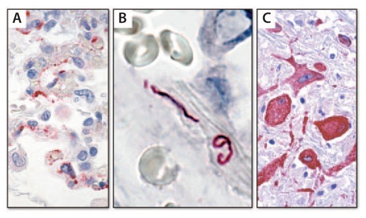 https://cdn.ncbi.nlm.nih.gov/pmc/blobs/5d7b/4584867/2fffd1b64f60/121-126f1.jpg