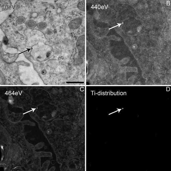 https://cdn.ncbi.nlm.nih.gov/pmc/blobs/5d7e/2826283/55f4c5e2b5ed/1743-8977-7-2-4.jpg