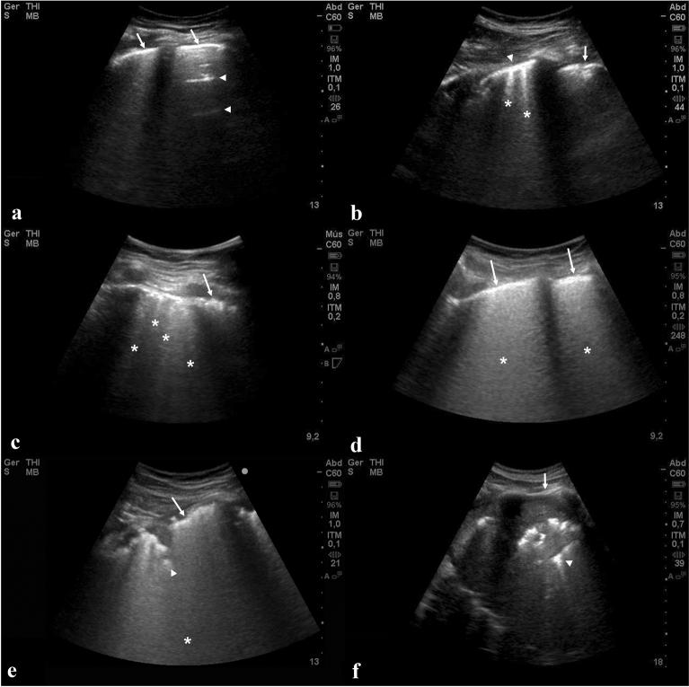 https://cdn.ncbi.nlm.nih.gov/pmc/blobs/5d82/7779089/3f7576e46c9b/134_2020_6328_Fig2_HTML.jpg