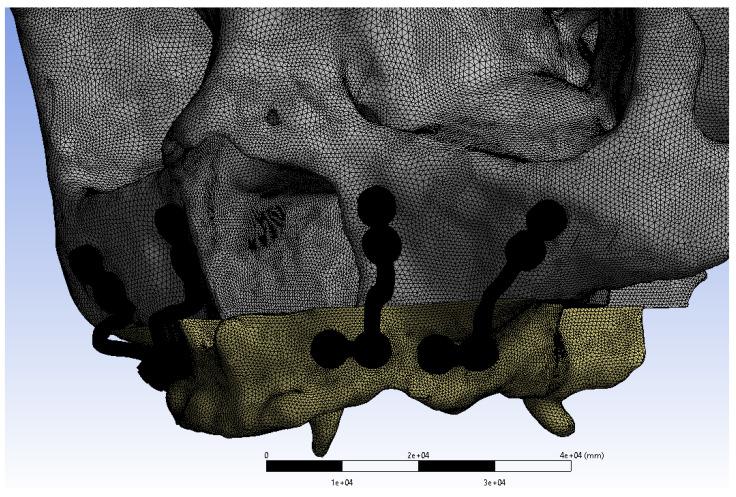 https://cdn.ncbi.nlm.nih.gov/pmc/blobs/5d89/12080587/68115990b485/ijmsv22p2257g003.jpg