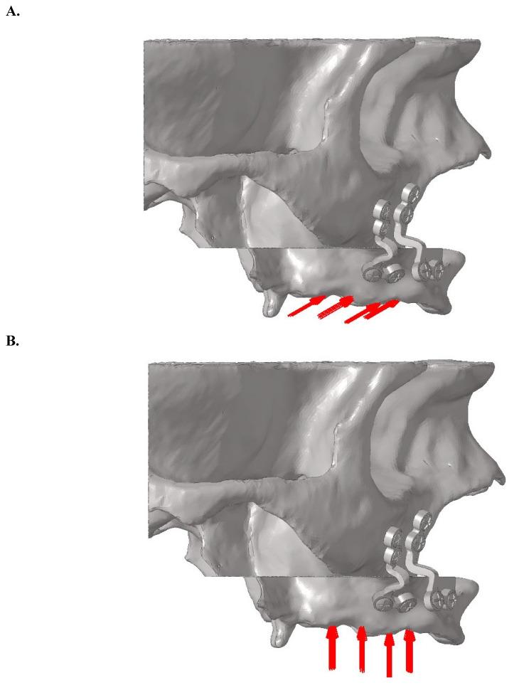 https://cdn.ncbi.nlm.nih.gov/pmc/blobs/5d89/12080587/b16a3f21a6c9/ijmsv22p2257g004.jpg