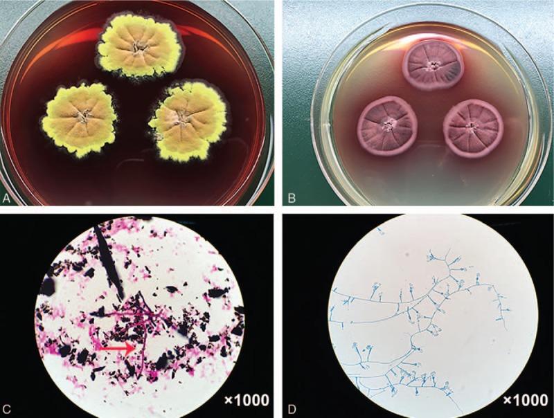 https://cdn.ncbi.nlm.nih.gov/pmc/blobs/5d97/5779773/296e3fd3721e/medi-97-e9658-g003.jpg