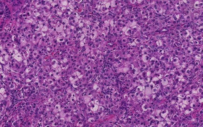 https://cdn.ncbi.nlm.nih.gov/pmc/blobs/5d99/6465943/4c98b86fa537/WJG-25-1653-g001.jpg