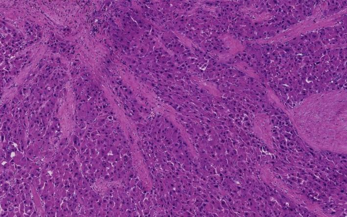 https://cdn.ncbi.nlm.nih.gov/pmc/blobs/5d99/6465943/dede2578951b/WJG-25-1653-g002.jpg