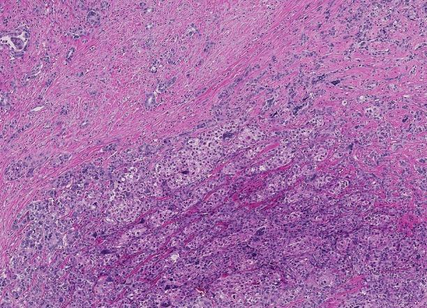 https://cdn.ncbi.nlm.nih.gov/pmc/blobs/5d99/6465943/ffb261e2e85e/WJG-25-1653-g004.jpg