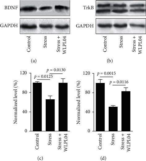 https://cdn.ncbi.nlm.nih.gov/pmc/blobs/5da1/7868149/7479d9dd924c/CJIDMM2021-6613903.005.jpg