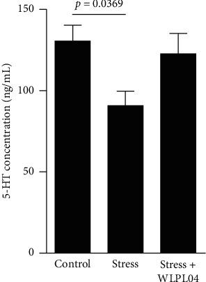 https://cdn.ncbi.nlm.nih.gov/pmc/blobs/5da1/7868149/85b8a3c23397/CJIDMM2021-6613903.004.jpg