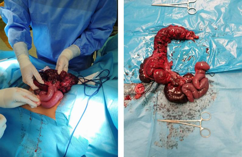 https://cdn.ncbi.nlm.nih.gov/pmc/blobs/5db3/11705119/91ee08109944/in_vivo-39-477-g0001.jpg
