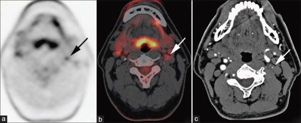 https://cdn.ncbi.nlm.nih.gov/pmc/blobs/5db5/7875029/edcc1e845b1a/WJNM-19-327-g004.jpg