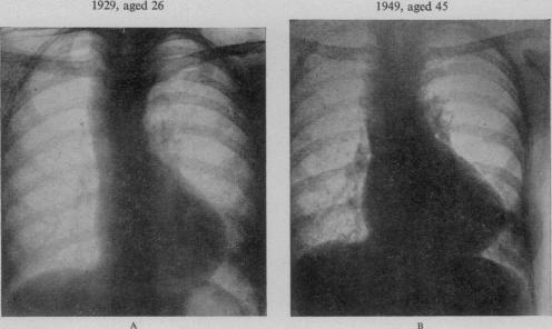 https://cdn.ncbi.nlm.nih.gov/pmc/blobs/5db6/1888892/5a379c017590/procrsmed00382-0030-a.jpg