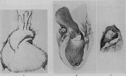 https://cdn.ncbi.nlm.nih.gov/pmc/blobs/5db6/1888892/dbc816e3063c/procrsmed00382-0029-a.jpg
