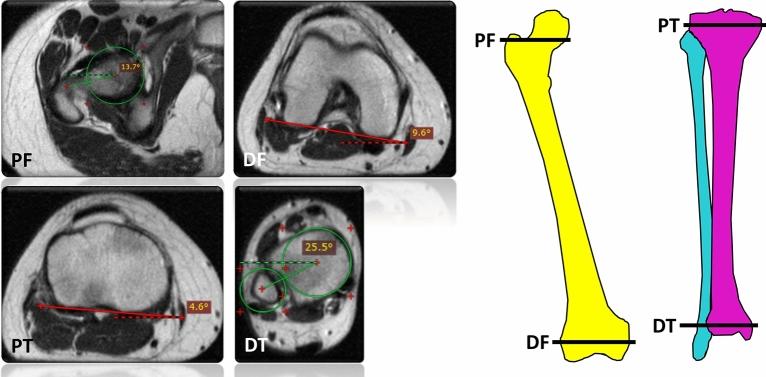 https://cdn.ncbi.nlm.nih.gov/pmc/blobs/5db6/8636587/19c007848892/41598_2021_2708_Fig2_HTML.jpg