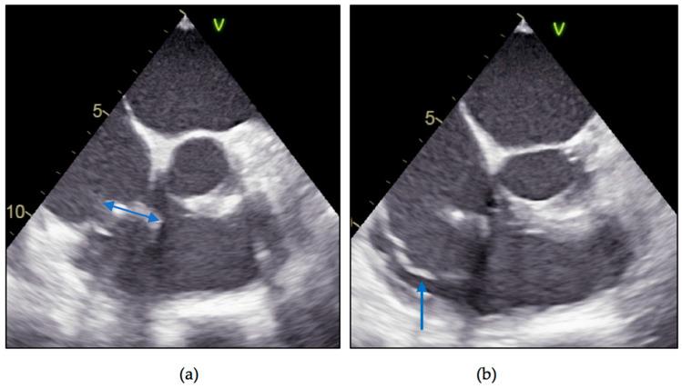 https://cdn.ncbi.nlm.nih.gov/pmc/blobs/5dd1/7827933/621c89c1e2b3/diagnostics-11-00096-g004.jpg