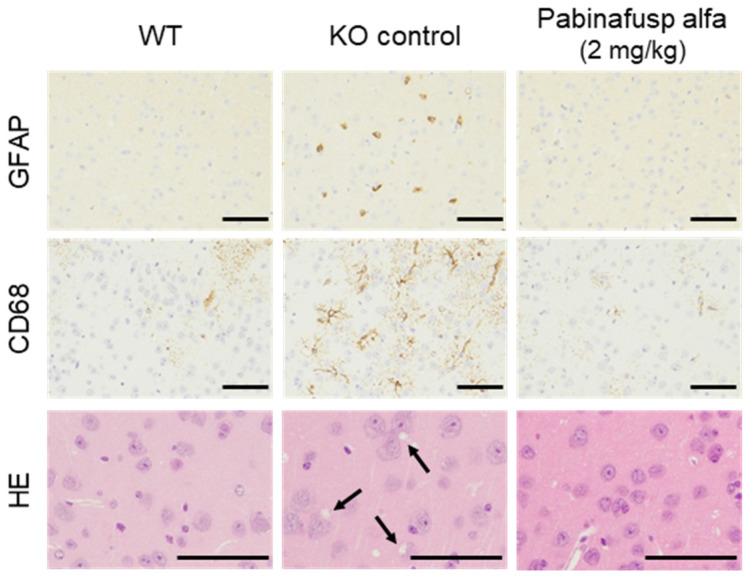 https://cdn.ncbi.nlm.nih.gov/pmc/blobs/5dd3/8535651/2243742b3212/ijms-22-10938-g003.jpg