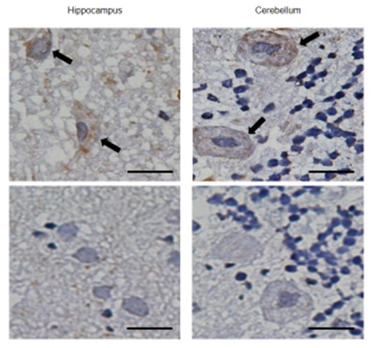 https://cdn.ncbi.nlm.nih.gov/pmc/blobs/5dd3/8535651/3a551c5d241e/ijms-22-10938-g001.jpg