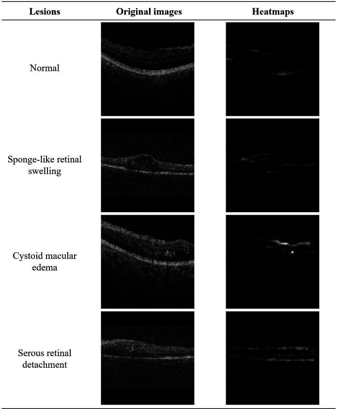 https://cdn.ncbi.nlm.nih.gov/pmc/blobs/5ddc/12128415/7ed6c8268005/bmjopen-15-5-g003.jpg