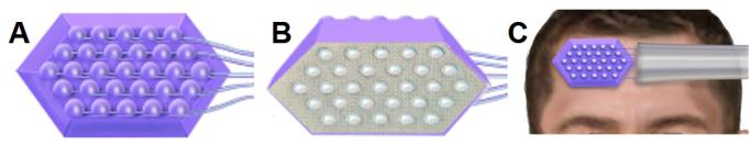 https://cdn.ncbi.nlm.nih.gov/pmc/blobs/5ddf/12330841/be087220c02a/IMAG.a.76_Fig1.jpg