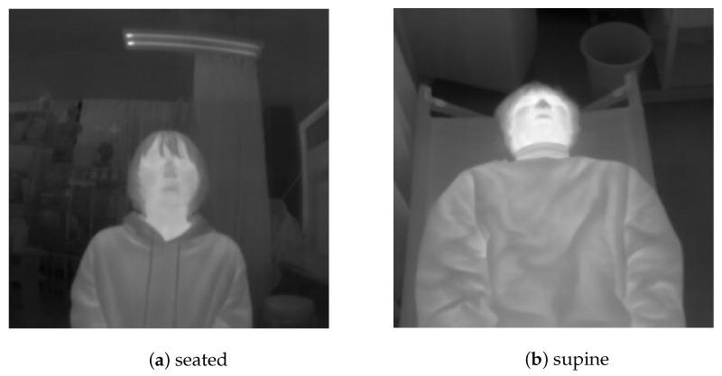 https://cdn.ncbi.nlm.nih.gov/pmc/blobs/5deb/8271612/13b7fb58d106/sensors-21-04406-g006.jpg