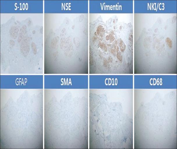 https://cdn.ncbi.nlm.nih.gov/pmc/blobs/5dec/3884944/d86fc72ff109/IJD-59-99-g003.jpg