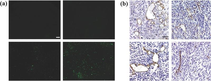 https://cdn.ncbi.nlm.nih.gov/pmc/blobs/5ded/5867128/93220de2b868/ADVS-5-1700263-g005.jpg