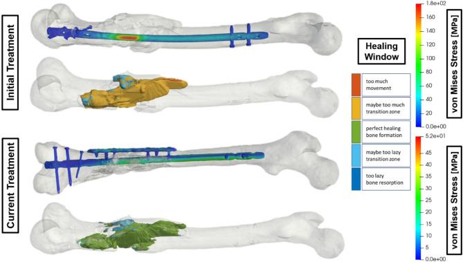 https://cdn.ncbi.nlm.nih.gov/pmc/blobs/5dee/12144170/3a62d1e43090/41598_2025_4792_Fig3_HTML.jpg