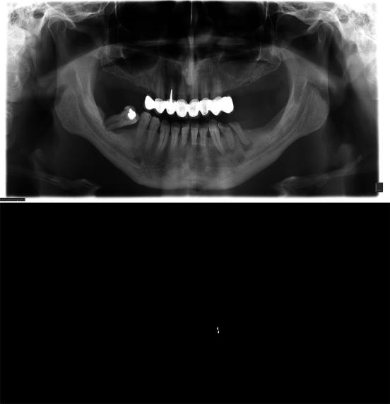 https://cdn.ncbi.nlm.nih.gov/pmc/blobs/5def/11128823/3c424302b4fa/gr001.jpg