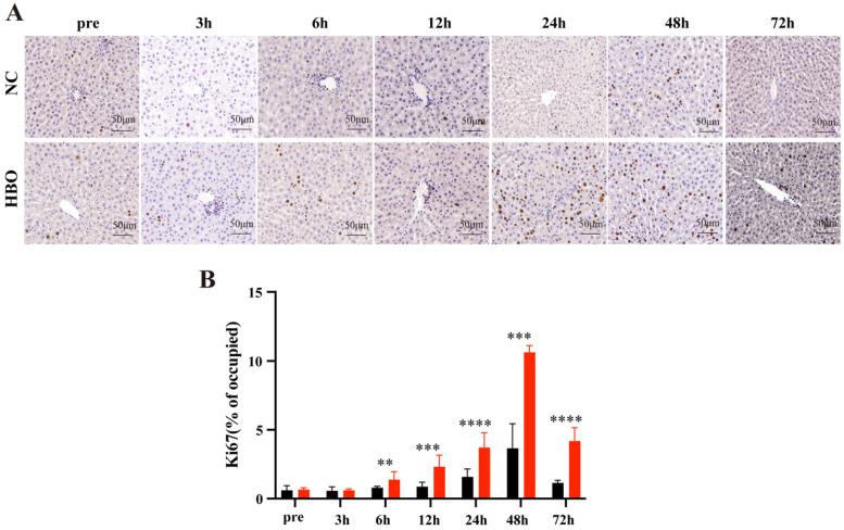 https://cdn.ncbi.nlm.nih.gov/pmc/blobs/5def/12035843/cd5fc17b6398/ijmsv22p2174g003.jpg