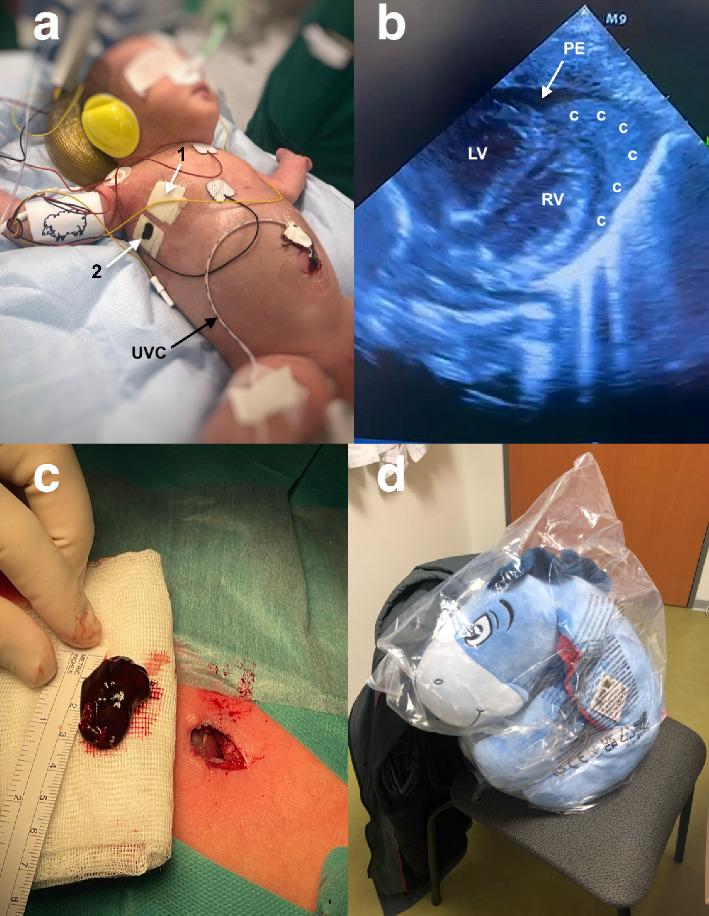 https://cdn.ncbi.nlm.nih.gov/pmc/blobs/5dfb/12103966/27b209d3fc25/CRIPE2025-7960753.002.jpg