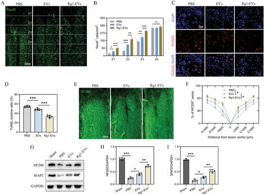 https://cdn.ncbi.nlm.nih.gov/pmc/blobs/5dfd/11336912/f9d212b77012/ADVS-11-2402114-g010.jpg