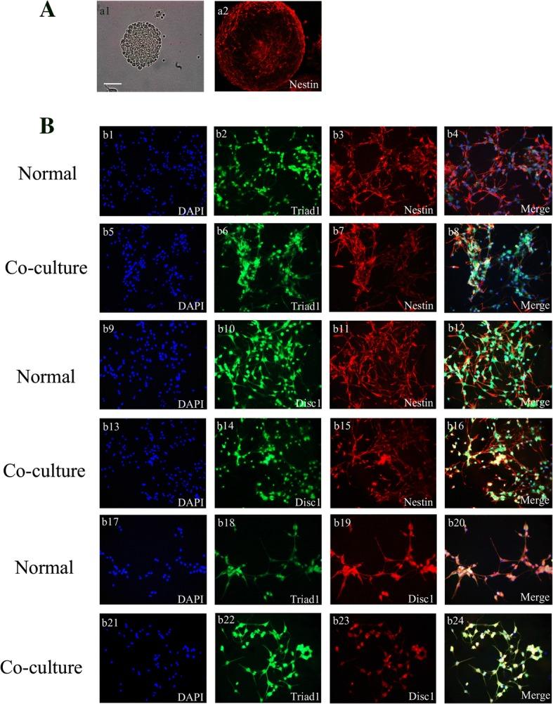 https://cdn.ncbi.nlm.nih.gov/pmc/blobs/5dff/6225628/3421dd841fe5/13287_2018_1024_Fig4_HTML.jpg