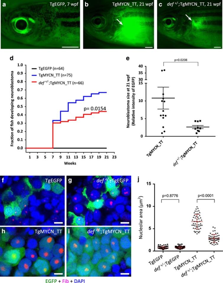 https://cdn.ncbi.nlm.nih.gov/pmc/blobs/5e04/5502316/7c12b41db5dc/onc2016527f2.jpg